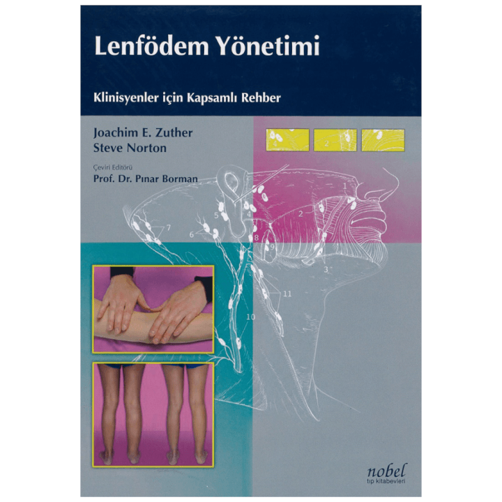 Lenfödem Yönetimi:Klinisyenler için Kapsamlı Rehber